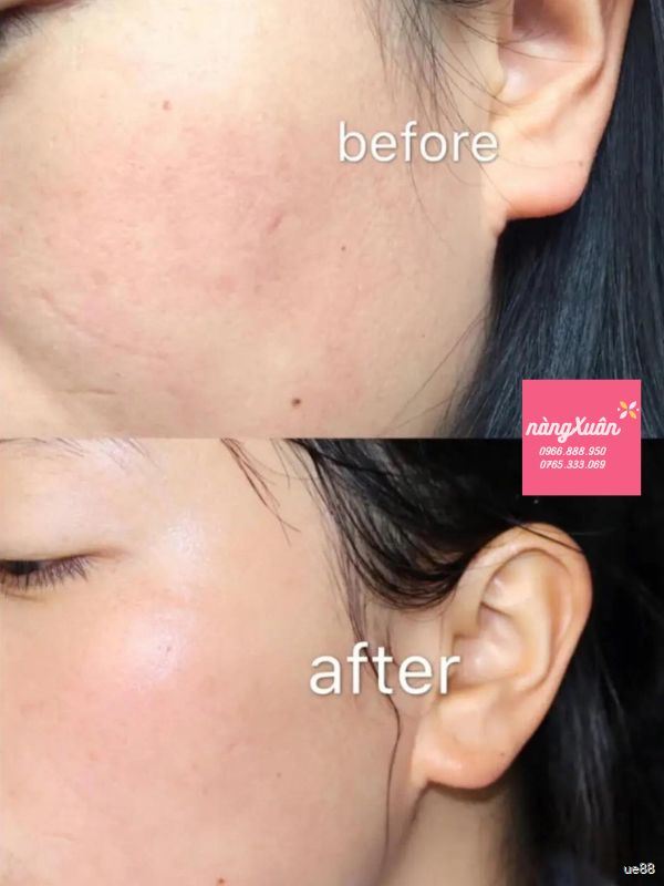 Kem Dưỡng Ngày OLAY Total Effects 7 in One Day Moisturiser Nourish Protect